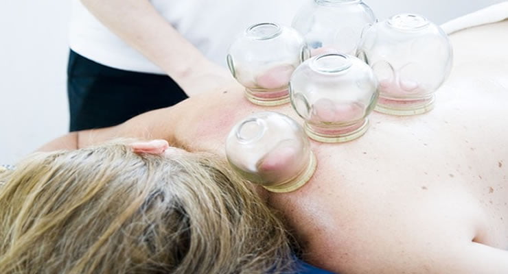 Massagem com Ventosas: Terapia Antiga para Alívio da Dor e Tensão 8 Massagem com Ventosas: Terapia Antiga para Alívio da Dor e Tensão